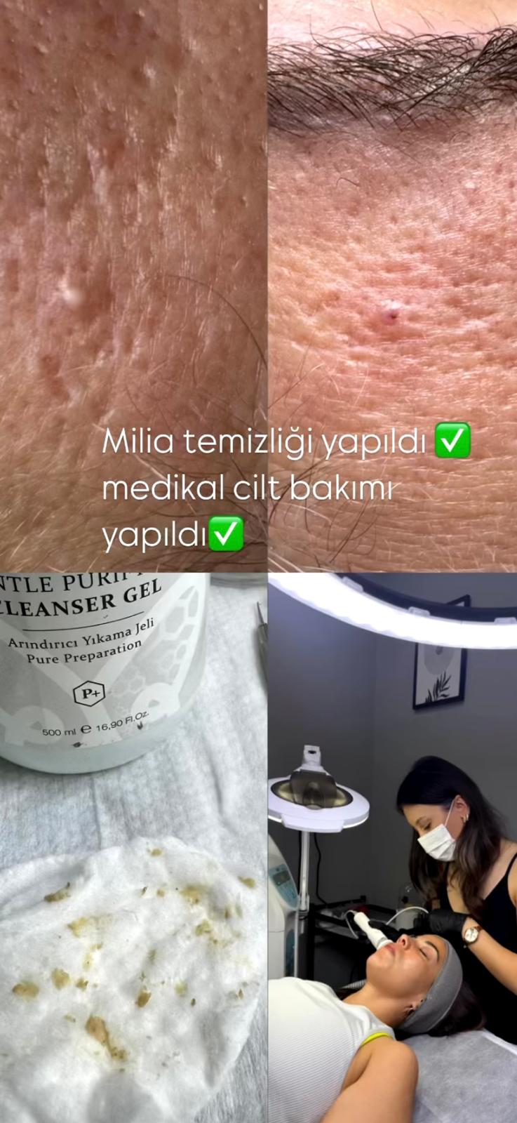 whatsapp görsel 2025 09 13 saat 20.58.35 dcafd177